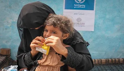 اخبار اليمن الان الأغذية العالمي إيقاف مشروع التغذية اخبار اليمن الان الحدث اليوم عاجل