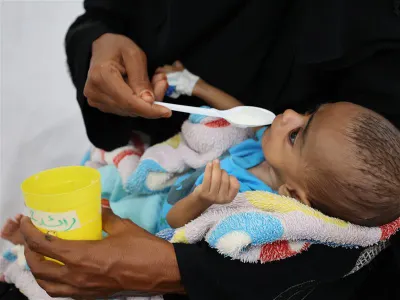 اخبار اليمن الان أطباء حدود تفاقم التغذية اليمن اخبار اليمن الان الحدث اليوم عاجل