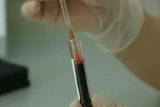 صحيفة المرصد اخبار اليمن الان الإيدز دراسة جديدة تكشف السبب اخبار اليمن الان الحدث اليوم عاجل صحيفة المرصد