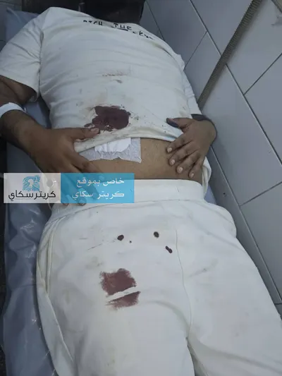 اخبار اليمن الان الشاب ونقله لغرفة العمليات مروعة اخبار اليمن الان الحدث اليوم عاجل