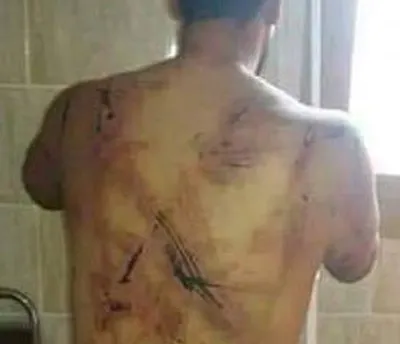 اخبار اليمن الان فضيحة إماراتية بتعذيب مواطن بطريقة اخبار اليمن الان الحدث اليوم عاجل