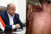 صحيفة المرصد اخبار اليمن الان تنفيذية سياسي النار الخنبشي المستور اخبار اليمن الان الحدث اليوم عاجل صحيفة المرصد