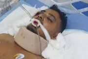 اخبار اليمن الان الحدث اليوم عاجل كريتر إسكاي