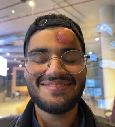 اخبار اليمن الان تسديدة رونالدو الصاروخية سعودي الرائد اخبار اليمن الان الحدث اليوم عاجل