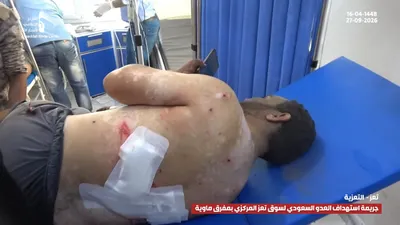 اخبار اليمن الان ومشاهد الجريمة السعودية المدنيين بمحافظة اخبار اليمن الان الحدث اليوم عاجل