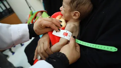 اخبار اليمن الان الغذاء العالمي اليمن مسبوقة الملايين اخبار اليمن الان الحدث اليوم عاجل