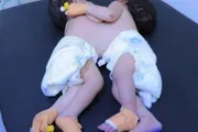 أحداث اليوم اخبار اليمن الان صنعاء سيامي أثناء للعلاج الخارج اخبار اليمن الان الحدث اليوم عاجل أحداث اليوم