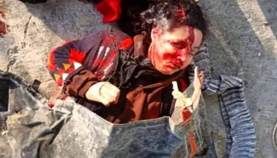 اخبار اليمن الان https www ypagency net 741199 اخبار اليمن الان الحدث اليوم عاجل