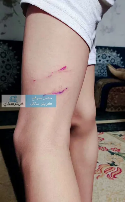 اخبار اليمن الان كلاب تهاجم أثناء عودته المسجد اخبار اليمن الان الحدث اليوم عاجل