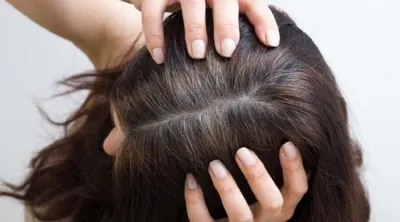 اخبار اليمن الان عوامل الشيب نصائح لتأخير انتشاره اخبار اليمن الان الحدث اليوم عاجل