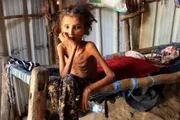 الموقع بوست اخبار اليمن الان اليمن الكارثة يدفعان ملايين الأطفال اخبار اليمن الان الحدث اليوم عاجل الموقع بوست