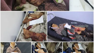 اخبار اليمن الان استشهاد مدفعية لمجندي الإصلاح بمنطقة اخبار اليمن الان الحدث اليوم عاجل