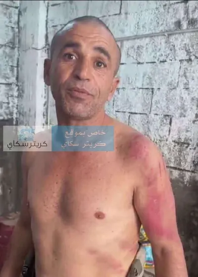 اخبار اليمن الان مواطن تعرضه للاعتداء ويطالب تحقيق اخبار اليمن الان الحدث اليوم عاجل