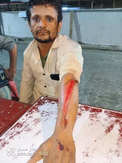 اخبار اليمن الان الحدث اليوم عاجل 