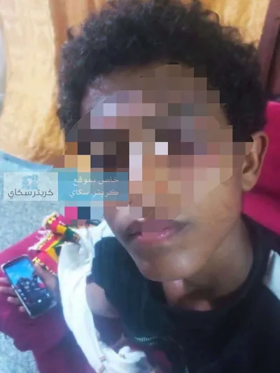 اخبار اليمن الان لصلاة الفجر مصابة اعتداء الغضب اخبار اليمن الان الحدث اليوم عاجل