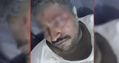 اخبار اليمن الان اصابة مواطن بانفجار مروع اخبار اليمن الان الحدث اليوم عاجل