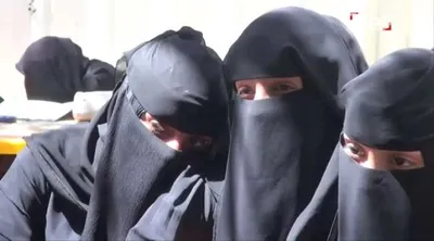 اخبار اليمن الان طالبة بجامعة صنعاء اليمنية لسبب اخبار اليمن الان الحدث اليوم عاجل