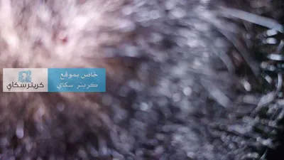 اخبار اليمن الان مواطن للتنمر المدرسة ومعلمة اصابته اخبار اليمن الان الحدث اليوم عاجل