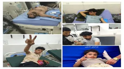 اخبار اليمن الان الحدث اليوم عاجل 